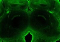 Grün markiertes neuronales Netzwerk im Bienengehirn. (Copyright: HHU/Institut für Evolutionsgenetik)