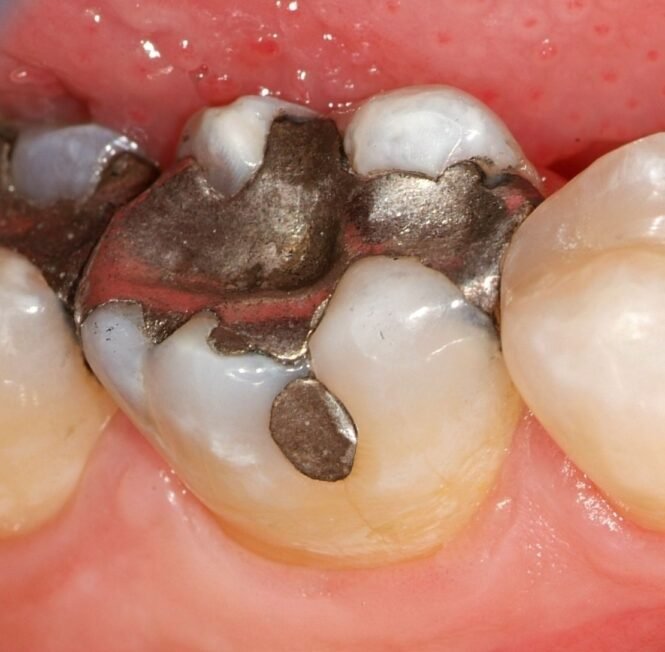 Credits: Cornelia Frese, UKHD