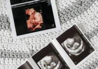 Credits: Pavel Danilyuk, pexels