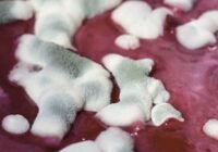 Credits: bogitw, pixabay