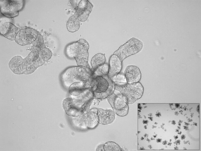 newsimage407412 1 | Pugnalom Credits: Max Kellner, HZI