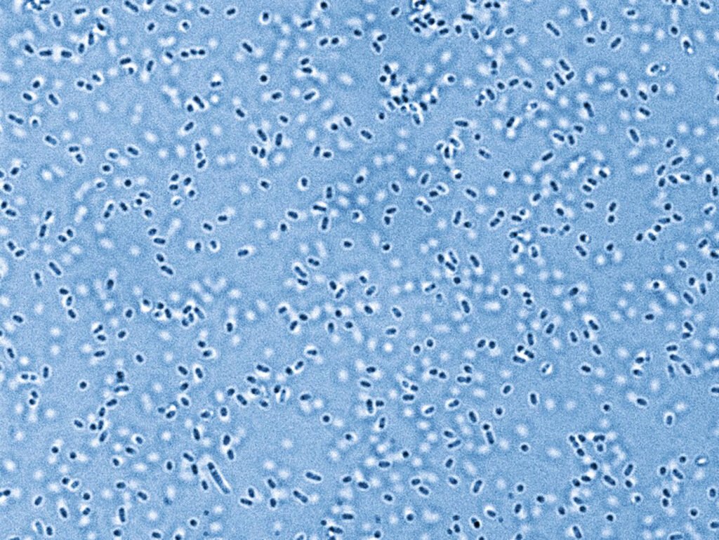 newsimage408594 | Pugnalom Pandoraea-Bakterien Credits: Elena Herzog, Leibniz-HKI