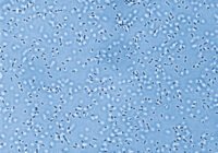 Pandoraea-Bakterien Credits: Elena Herzog, Leibniz-HKI