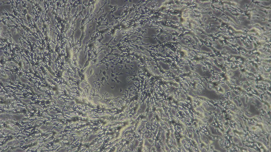 Bei Nahrungsmangel formen sich Amöben zu vielzelligen Fruchtkörpern, um neue Wirtszellen zu infizieren. Credits: Lukas Helmlinger