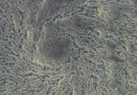 Bei Nahrungsmangel formen sich Amöben zu vielzelligen Fruchtkörpern, um neue Wirtszellen zu infizieren. Credits: Lukas Helmlinger