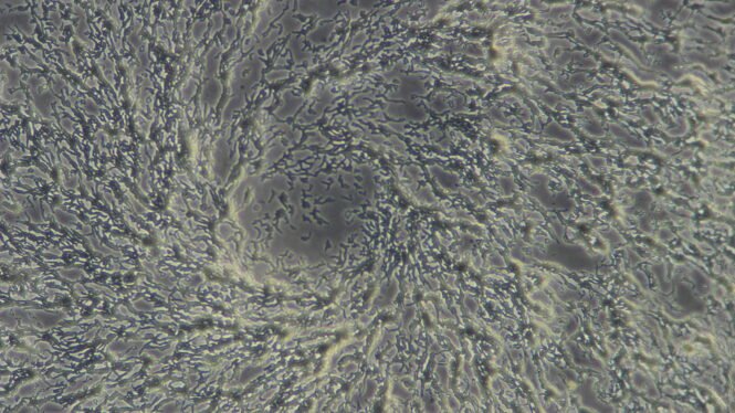 Bei Nahrungsmangel formen sich Amöben zu vielzelligen Fruchtkörpern, um neue Wirtszellen zu infizieren. Credits: Lukas Helmlinger