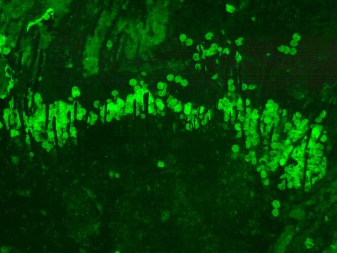 202509eierbb5 | Pugnalom