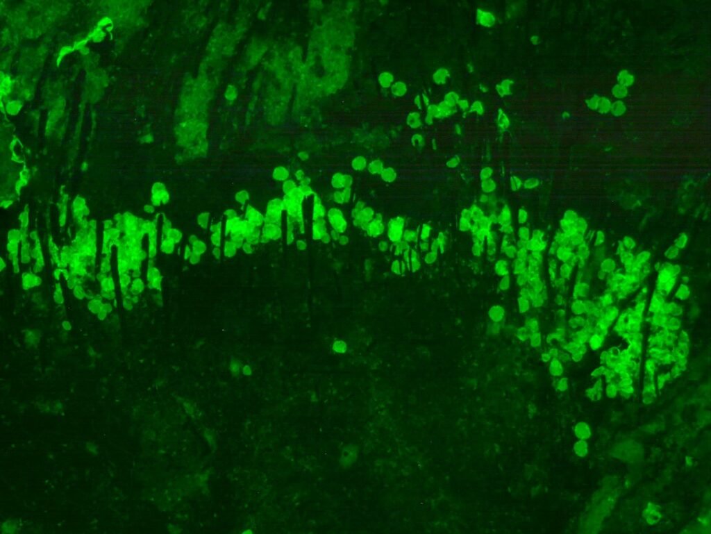 202509eierbb54957948512510877631 | Pugnalom