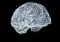 3D wireframe model of a human brain against a black background, showing intricate neural folds in light blue/white tones.