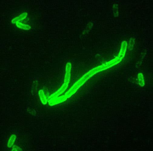 Fluorescent green rod-shaped bacteria visible against a dark background under a microscope.