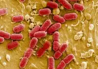 Escherichia coli unter dem Mikroskop. Credits: Manfred Rohde, HZI Center for Infection Research